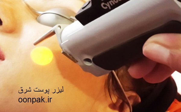 مرکز لیزر شرق تهران تهرانپارس بهترین خدمات لیزر و مو های زائد